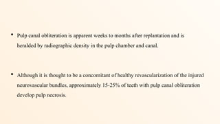 Pulp Bundle 11.avulsion ppt.pptx trauma of anterior teeth | PPTX