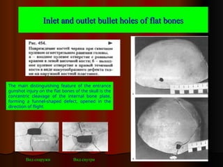 Comprehensive Analysis of Gunshot Damage and Forensic Ballistics | PPT