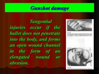Abrading Form Comprehensive Analysis of Gunshot Damage and Forensic Ballistics | PPT