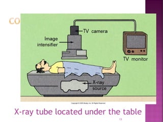 Comprehensive Overview of Fluoroscopy in Radiology and Diagnostic ...