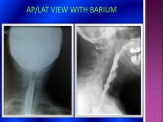 Comprehensive Overview of Fluoroscopy in Radiology and Diagnostic ...