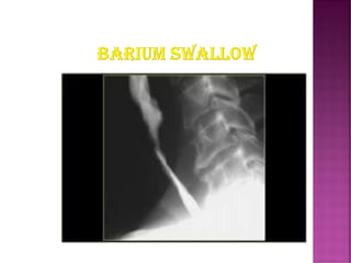 Comprehensive Overview of Fluoroscopy in Radiology and Diagnostic ...