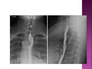 Comprehensive Overview of Fluoroscopy in Radiology and Diagnostic ...