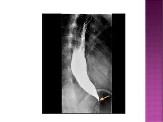 Comprehensive Overview of Fluoroscopy in Radiology and Diagnostic ...