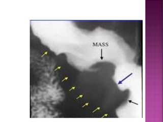 Comprehensive Overview of Fluoroscopy in Radiology and Diagnostic ...