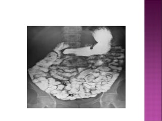 Comprehensive Overview of Fluoroscopy in Radiology and Diagnostic ...