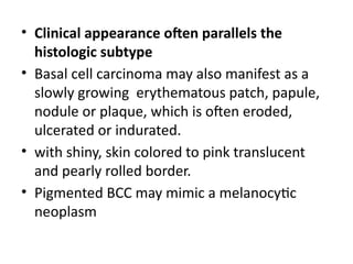 Comprehensive Overview of Basal Cell Carcinoma: Clinical and Histologic ...