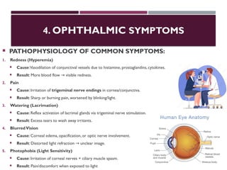 4. OPHTHALMIC SYMPTOMS
 PATHOPHYSIOLOGY OF COMMON SYMPTOMS:
1. Redness (Hyperemia)
 Cause:Vasodilation of conjunctival vessels due to histamine, prostaglandins, cytokines.
 Result: More blood flow visible redness.
→
2. Pain
 Cause: Irritation of trigeminal nerve endings in cornea/conjunctiva.
 Result: Sharp or burning pain, worsened by blinking/light.
3. Watering (Lacrimation)
 Cause: Reflex activation of lacrimal glands via trigeminal nerve stimulation.
 Result: Excess tears to wash away irritants.
4. BlurredVision
 Cause: Corneal edema, opacification, or optic nerve involvement.
 Result: Distorted light refraction unclear image.
→
5. Photophobia (Light Sensitivity)
 Cause: Irritation of corneal nerves + ciliary muscle spasm.
 Result: Pain/discomfort when exposed to light
 