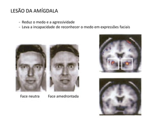 LESÃO DA AMÍGDALA
- Reduz o medo e a agressividade
- Leva a incapacidade de reconhecer o medo em expressões faciais
Face neutra Face amedrontada
 