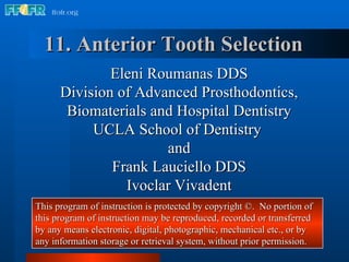 11. Anterior Tooth Selection Eleni Roumanas DDS Division of Advanced Prosthodontics, Biomaterials and Hospital Dentistry UCLA School of Dentistry  and Frank Lauciello DDS Ivoclar Vivadent This program of instruction is protected by copyright ©.  No portion of this program of instruction may be reproduced, recorded or transferred by any means electronic, digital, photographic, mechanical etc., or by any information storage or retrieval system, without prior permission. 