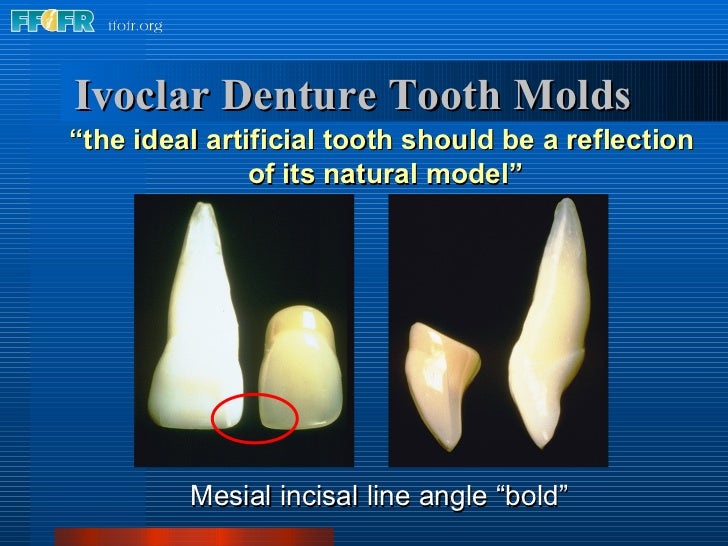 11.anterior tooth selection