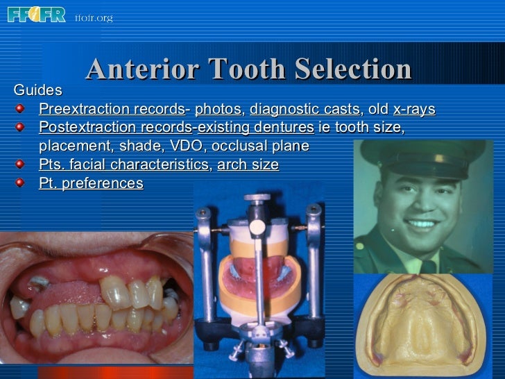 11.anterior tooth selection