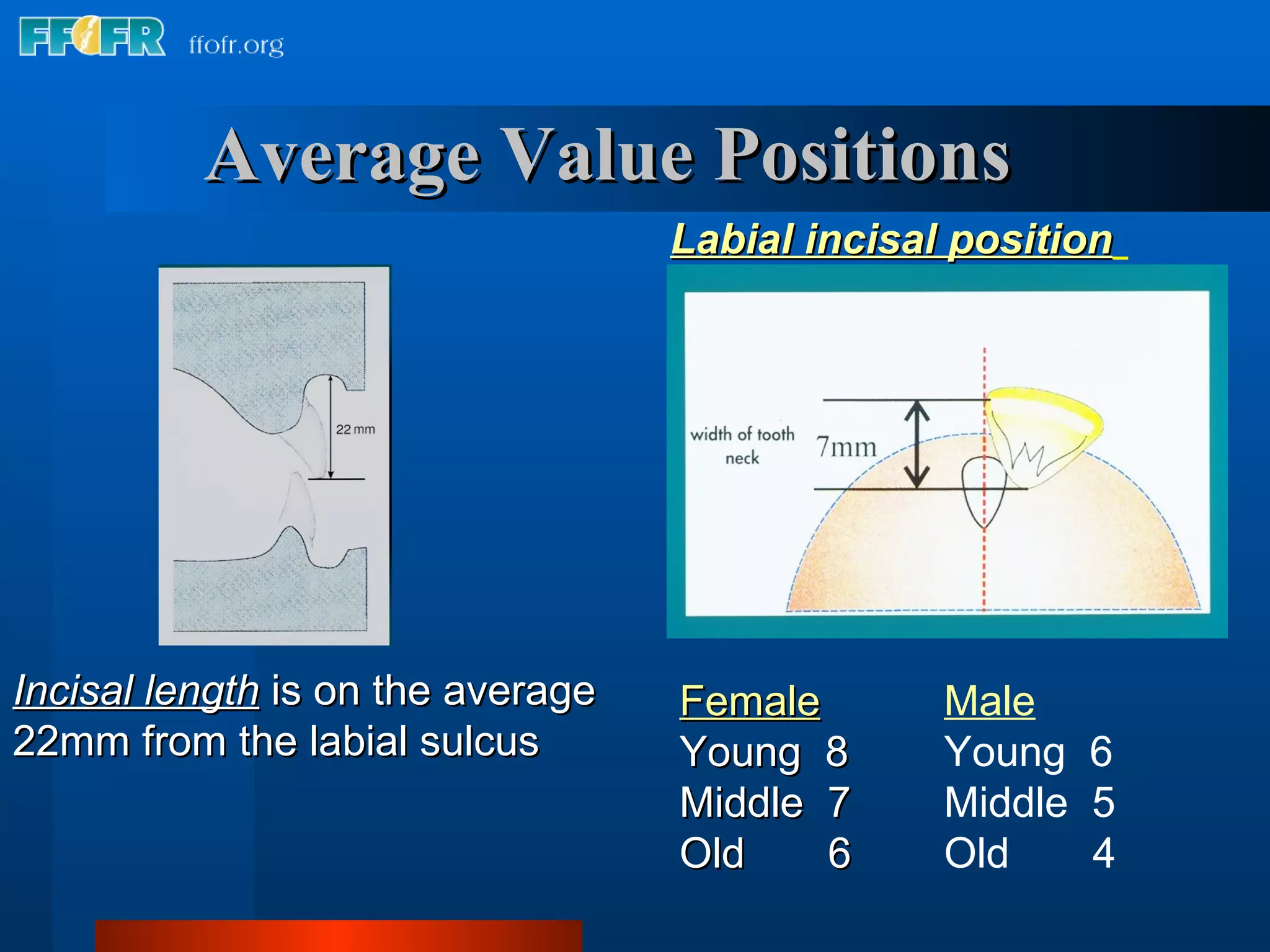 11.anterior tooth selection | PPT