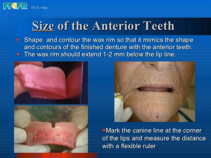 11.anterior tooth selection