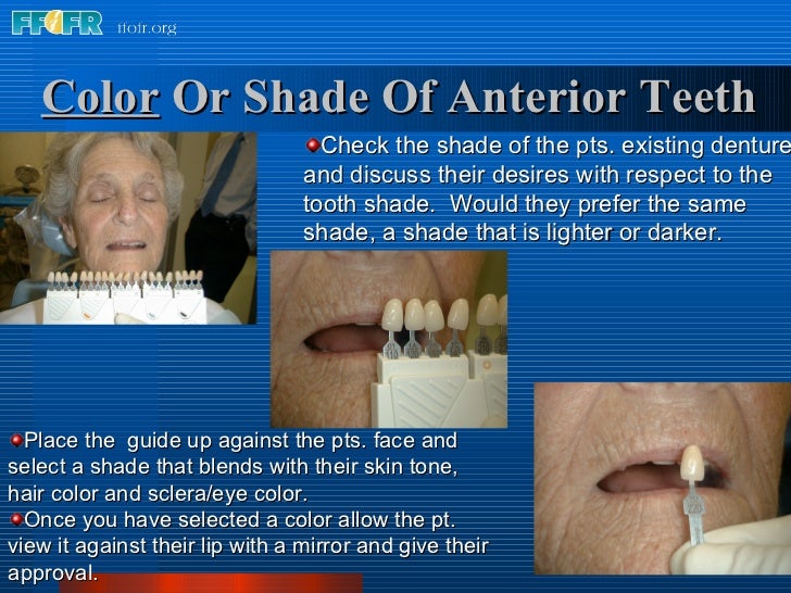 11.anterior tooth selection
