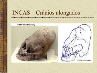 INCAS – Crânios alongados
 