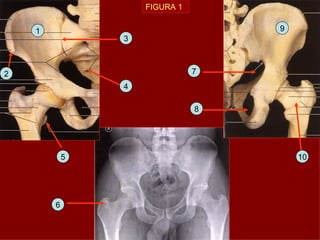 FIGURA 1 1 6 10 2 5 8 4 9 3 7 