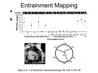 Entrainment Mapping




24   Olgin et al. J of Cardiovasc Electrophysiology Vol.7,No.11,Nov 96
 