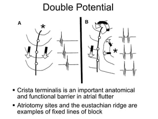 Double Potential




      Crista terminalis is an important anatomical
       and functional barrier in atrial flutter
      Atriotomy sites and the eustachian ridge are
25     examples of fixed lines of block
 