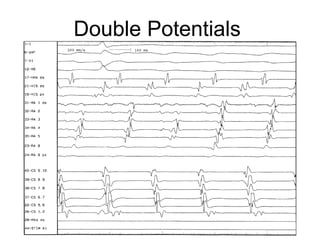 Double Potentials




26
 