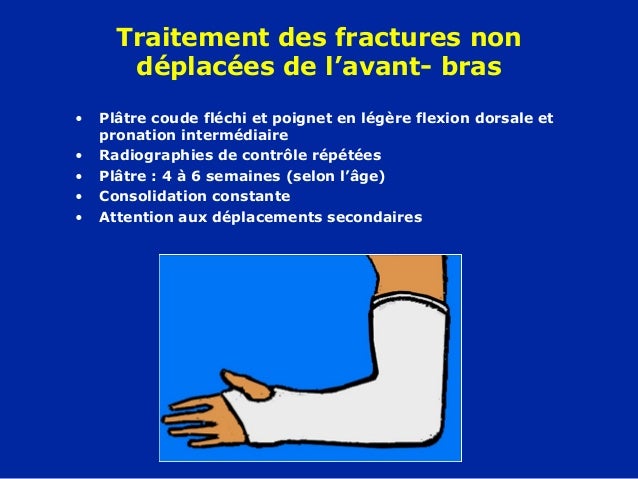Largile bleu clair le traitement osteokhondroza du cervical