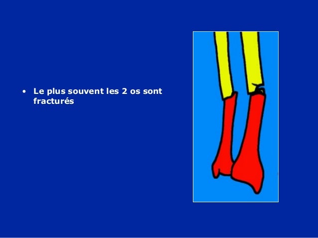 Comme guérir la douleur dans les muscles du cou du dos