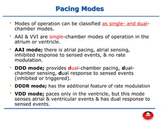 Normal Vvi Pacemaker Mode Comprehensive Overview of Cardiac Pacemakers and Implantable ...