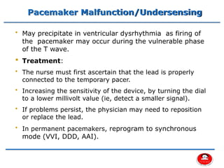 Decrease Sensitivity Pacemaker Comprehensive Overview of Cardiac Pacemakers and Implantable ...