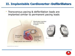 Comprehensive Overview of Cardiac Pacemakers and Implantable ...
