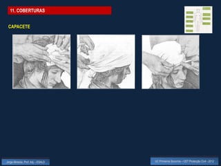 11. COBERTURAS


 CAPACETE




Jorge Almeida, Prof. Adj. - ESALD   UC Primeiros Socorros – CET Protecção Civil - 2012
 