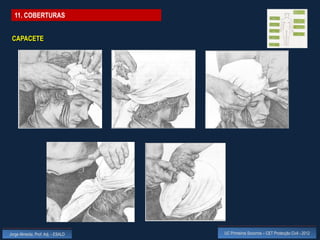 11. COBERTURAS


 CAPACETE




Jorge Almeida, Prof. Adj. - ESALD   UC Primeiros Socorros – CET Protecção Civil - 2012
 