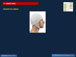11. COBERTURAS


 CRUZADO DA CABEÇA




Jorge Almeida, Prof. Adj. - ESALD   UC Primeiros Socorros – CET Protecção Civil - 2012
 