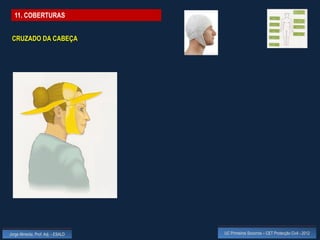 11. COBERTURAS


 CRUZADO DA CABEÇA




Jorge Almeida, Prof. Adj. - ESALD   UC Primeiros Socorros – CET Protecção Civil - 2012
 