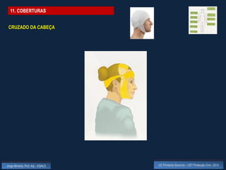 11. COBERTURAS


 CRUZADO DA CABEÇA




Jorge Almeida, Prof. Adj. - ESALD   UC Primeiros Socorros – CET Protecção Civil - 2012
 