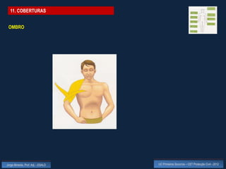 11. COBERTURAS


 OMBRO




Jorge Almeida, Prof. Adj. - ESALD   UC Primeiros Socorros – CET Protecção Civil - 2012
 