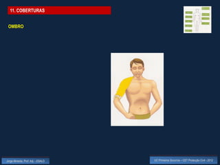 11. COBERTURAS


 OMBRO




Jorge Almeida, Prof. Adj. - ESALD   UC Primeiros Socorros – CET Protecção Civil - 2012
 