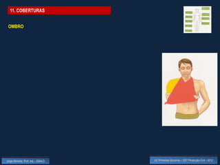 11. COBERTURAS


 OMBRO




Jorge Almeida, Prof. Adj. - ESALD   UC Primeiros Socorros – CET Protecção Civil - 2012
 