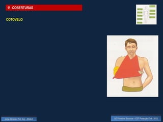 11. COBERTURAS


 COTOVELO




Jorge Almeida, Prof. Adj. - ESALD   UC Primeiros Socorros – CET Protecção Civil - 2012
 