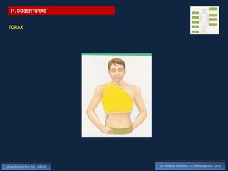 11. COBERTURAS


 TORAX




Jorge Almeida, Prof. Adj. - ESALD   UC Primeiros Socorros – CET Protecção Civil - 2012
 
