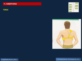 11. COBERTURAS


 TORAX




Jorge Almeida, Prof. Adj. - ESALD   UC Primeiros Socorros – CET Protecção Civil - 2012
 