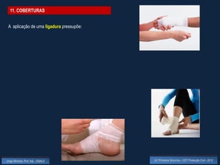 11. COBERTURAS


 A aplicação de uma ligadura pressupõe:




Jorge Almeida, Prof. Adj. - ESALD         UC Primeiros Socorros – CET Protecção Civil - 2012
 