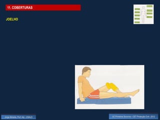 11. COBERTURAS


 JOELHO




Jorge Almeida, Prof. Adj. - ESALD   UC Primeiros Socorros – CET Protecção Civil - 2012
 