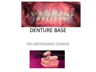 DENTURE BASE
DR.ABDISAMAD OSMAN
 