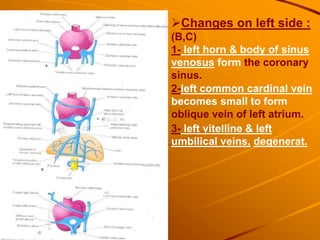 Changes on left side :
(B,C)
1- left horn & body of sinus
venosus form the coronary
sinus.
2-left common cardinal vein
becomes small to form
oblique vein of left atrium.
3- left vitelline & left
umbilical veins, degenerat.
 