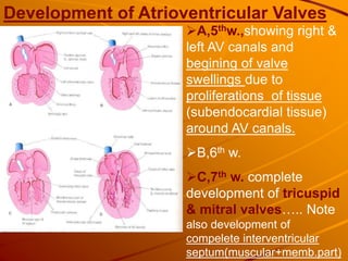 Development of Atrioventricular Valves
A,5thw.,showing right &
left AV canals and
begining of valve
swellings due to
proliferations of tissue
(subendocardial tissue)
around AV canals.
B,6th w.
C,7th w. complete
development of tricuspid
& mitral valves….. Note
also development of
compelete interventricular
septum(muscular+memb.part)
 