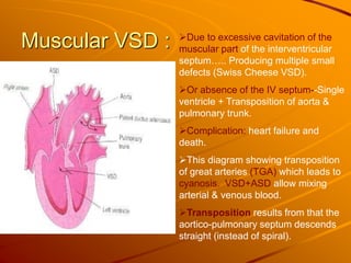 Muscular VSD : Due to excessive cavitation of the
muscular part of the interventricular
septum….. Producing multiple small
defects (Swiss Cheese VSD).
Or absence of the IV septum--Single
ventricle + Transposition of aorta &
pulmonary trunk.
Complication: heart failure and
death.
This diagram showing transposition
of great arteries (TGA) which leads to
cyanosis. VSD+ASD allow mixing
arterial & venous blood.
Transposition results from that the
aortico-pulmonary septum descends
straight (instead of spiral).
 