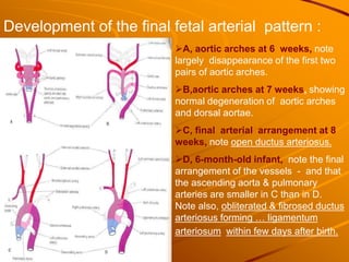 Development of the final fetal arterial pattern :
A, aortic arches at 6 weeks, note
largely disappearance of the first two
pairs of aortic arches.
B,aortic arches at 7 weeks, showing
normal degeneration of aortic arches
and dorsal aortae.
C, final arterial arrangement at 8
weeks, note open ductus arteriosus.
D, 6-month-old infant, note the final
arrangement of the vessels - and that
the ascending aorta & pulmonary
arteries are smaller in C than in D.
Note also, obliterated & fibrosed ductus
arteriosus forming … ligamentum
arteriosum within few days after birth.
 