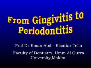 From Gingivitis to  Periodontitis Prof Dr.Eman Abd - Elsattar Tella Faculty of Dentistry, Umm Al Qurra University,Makka. 