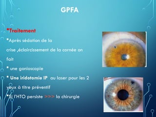 GPFA
Traitement
Après sédation de la
crise ,éclaircissement de la cornée on
fait
 une gonioscopie
 Une iridotomie IP au laser pour les 2
yeux à titre préventif
Si l’HTO persiste >>> la chirurgie
 