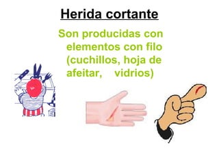 Herida cortante
Son producidas con
elementos con filo
(cuchillos, hoja de
afeitar, vidrios)
 